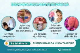 Hậu quả khó lường mà bệnh sùi mào gà gây ra và cách chữa trị