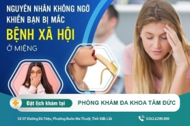 Biểu hiện của người mắc bệnh sùi mào gà ở lưỡi