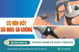 Phương pháp đốt sùi mào gà như thế nào? Những điều cần biết khi đốt sùi mào gà
