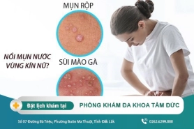 Cách khắc phục nổi mụn ở vùng kín nữ giới