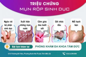 Mụn rộp sinh dục là gì? Cách chữa mụn rộp sinh dục thế nào
