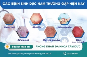 Bệnh sinh dục ở nam giới là những bệnh gì?