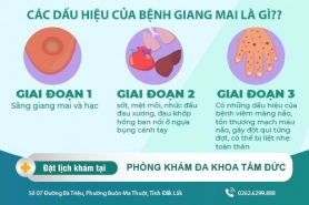 Dấu hiệu bệnh giang mai và cách điều trị khi mắc phải