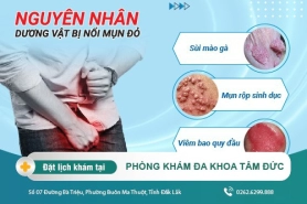 Dương vật nổi mụn đỏ có nguy hiểm không? Cách điều trị hiệu quả