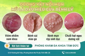 Nổi mụn mủ dương vật báo hiệu bệnh nguy hiểm - cách điều trị phù hợp