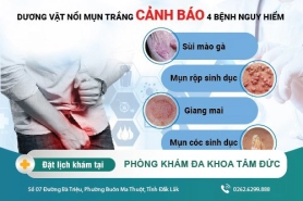 Dương vật bị nổi mụn trắng là dấu hiệu của bệnh gì và Cách chữa trị phù hợp