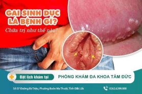 Gai sinh dục là bệnh gì? Chữa trị như thế nào