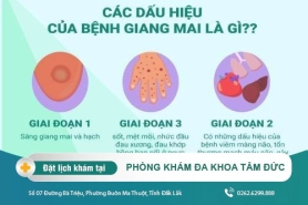 Giang mai là bệnh gì? Nguyên nhân dấu hiệu và cách chữa trị tốt nhất