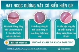 Chuỗi hạt ngọc dương vật và cách điều trị hiệu quả như thế nào?