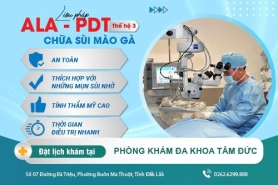 Phương pháp trị sùi mào gà hiệu quả được các chuyên gia tư vấn