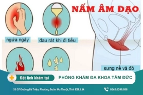 Biểu hiện nhiễm nấm ở vùng kín