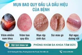 Một số lý do khiến quy đầu bị nổi mụn? Cách khắc phục mụn ở quy đầu?