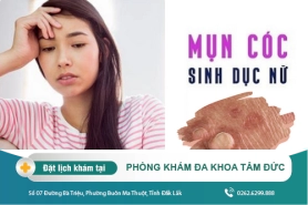 Cách nhận biết mục cóc sinh dục ở nữ giới