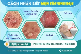 Nhận biết mụn cóc sinh dục cùng bác sĩ chuyên khoa - Phương pháp chữa trị bệnh kịp thời