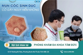 Dấu hiệu của mụn cóc sinh dục như thế nào? Cách chữa trị bệnh