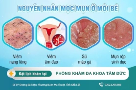 Mọc mụn ở môi bé có sao không? Một số cách điều trị hiệu quả