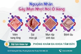 Nổi nhọt ở vùng kín - Tác hại và một số phương pháp điều trị hiệu quả