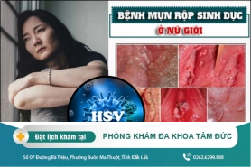 Bệnh mụn rộp sinh dục ở nữ giới là gì? Bệnh có nguy hiểm không?
