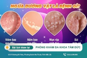 Dương vật bị ngứa do đâu? nguyên nhân và cách khắc phục