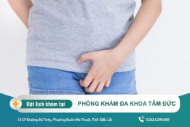 Nguyên nhân bị ngứa vùng kín? Phương pháp điều trị giảm ngứa nhanh