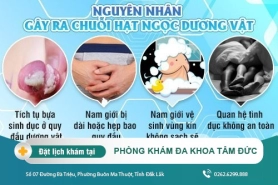 Chuổi hạt ngọc dương vật là bệnh gì? Nguyên nhân và cách điều trị