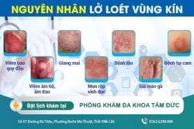 Vùng kín bị lở loét báo hiệu bệnh lý nguy hiểm, cách chữa trị hiệu quả