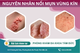 Vùng kín nữ xuất hiện ngứa và nổi mụn phải làm sao?