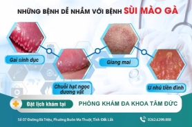 Bệnh dễ nhầm với sùi mào gà là gì? Cách nhận biết và điều trị ra sao