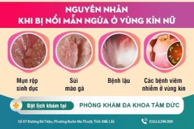 Vùng kín bị ngứa sưng là dấu hiệu gì? cách điều trị bệnh nhanh chóng