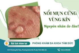 Nổi mụn cứng ở vùng kín khiến bạn khó chịu - Điều trị sớm tránh những biến chứng
