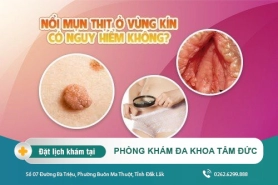 Nổi mụn thịt ở vùng kín có nguy hiểm không? điều trị bằng cách nào