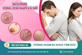 Tìm hiểu các loại mụn nổi ở vùng kín nam và nữ thường mắc phải