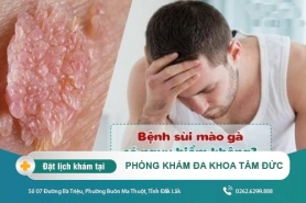 Sùi mào gà có nguy hiểm không? điều trị bằng cách nào