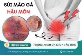 Cách nhận biết sùi mào gà bên trong hậu môn. Tìm hiểu về bệnh sùi mào gà