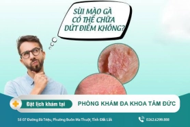 Cách điều trị sùi mào gà tại Đắk Lắk - Nhận biết sớm sùi mào gà bằng cách nào?