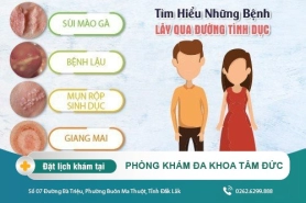 Bệnh lây qua đường tình dục và cách điều trị hiệu quả