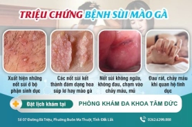 Triệu chứng của sùi mào gà là gì? Phương pháp điều trị bệnh