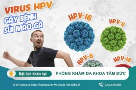 Tại sao bị sùi mào gà - nguyên nhân phổ biến
