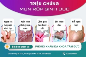 Cách Nhận Biết Và Chữa Trị Mụn Rộp Sinh Dục Hiệu Quả