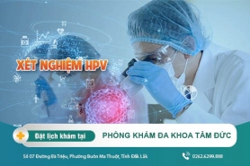 Xét nghiệm HPV như thế nào? Xác định bệnh liên quan đến virus HPV nhanh chóng