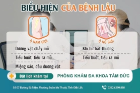 Dấu hiệu nhận biết sớm bệnh lậu và cách điều trị