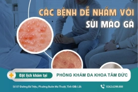 Những Bệnh Dễ Nhầm Lẫn Với Sùi Mào Gà Bạn Nên Biết