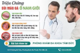 Chi tiết về hiện tượng sùi mào gà ở nam giới