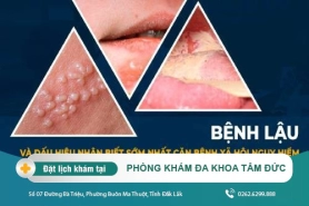 Cách chữa trị bệnh lậu tại Đắk Lắk – Bệnh lậu có lây không?