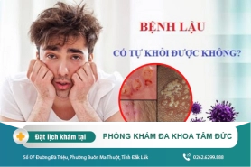 Cách chữa bệnh lậu tại Đắk Lắk - Bệnh lậu ở dương vật có nguy hiểm không?