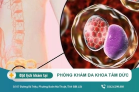 Cách chữa bệnh lậu hiệu quả tại Phòng Khám Đa Khoa Tâm Đức - Bệnh lậu có chữa khỏi được không?