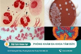 Cách trị bệnh lậu tại Đắk Lắk – Tác hại của bệnh lậu là gì?