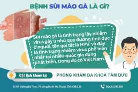 Sùi Mào Gà Có Lây Không Và Lây Qua Đường Nào?