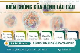 Cách chữa bệnh lậu cầu tại Phòng Khám Đa Khoa Tâm Đức – Triệu chứng bệnh lậu cầu ở nam giới là gì?