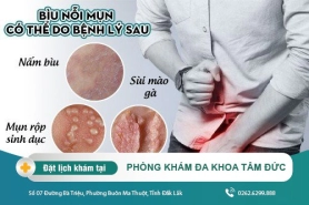 Giải đáp thắc mắc về bìu bị nổi mụn